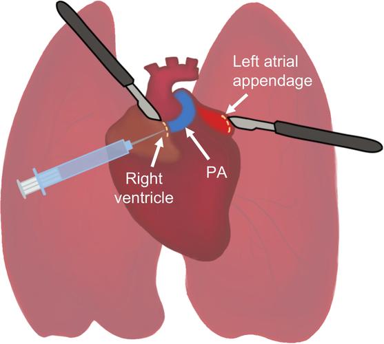 om artery in heart,Understanding the Om artery in the Heart: A Comprehensive Guide