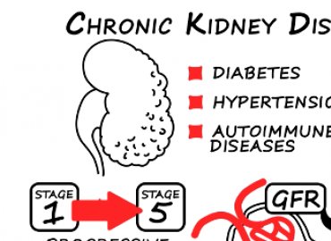 oms disease,Understanding OMS Disease: A Comprehensive Overview