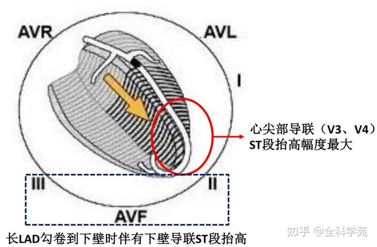 om 1 artery,Understanding the Om 1 Artery: A Comprehensive Guide